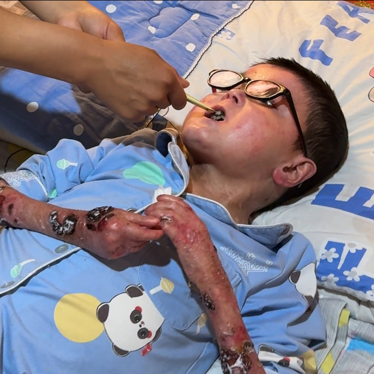 帮助凯威对抗红斑狼疮