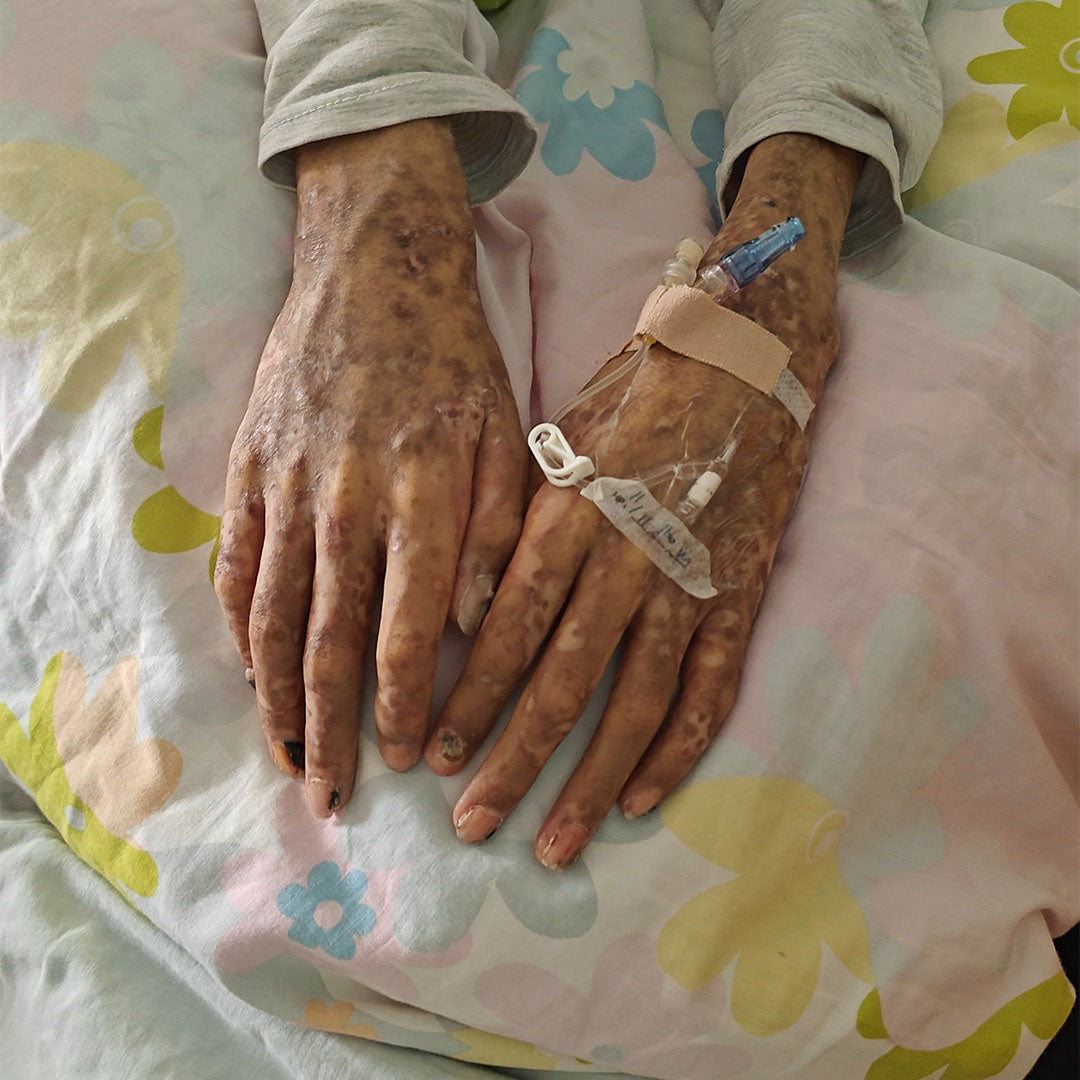 緊急救助白血病少年，命懸一線！