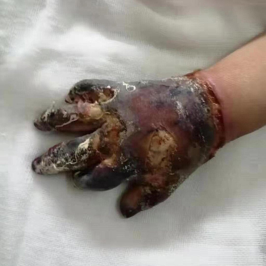 給萍萍帶去希望和光明