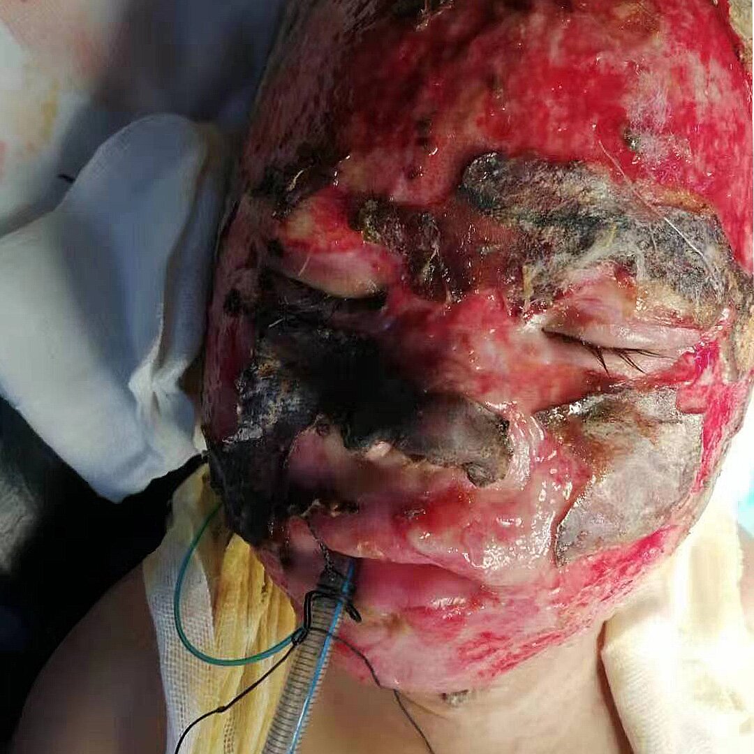 給萍萍帶去希望和光明